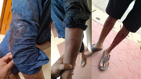 Goa Assault Case