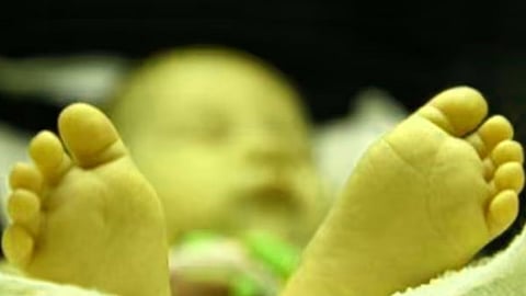 ''...तर हिरव्या त्वचेची बाळं जन्माला येतील''; संशोधकांचा इशारा