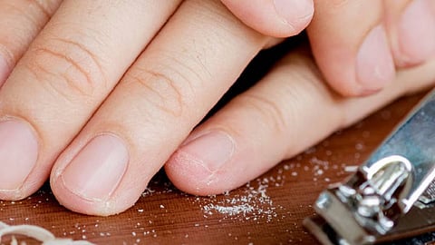 तुमच्या कापलेल्या नखांचा भाव 7500000?