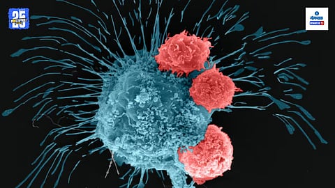 Appendix Cancer Study 2025