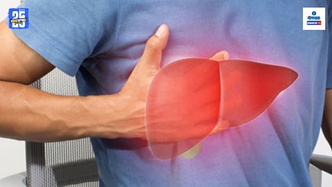 Non-Alcoholic Fatty Liver Disease