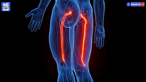 Sciatica Treatment And Prevention