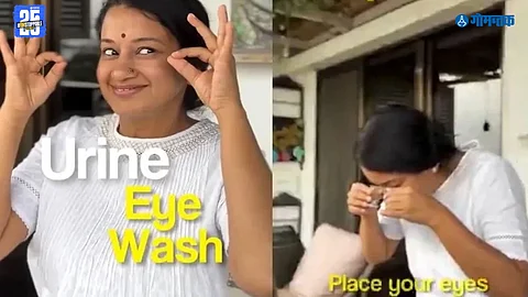 Urine Eye Cleaning