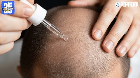 Finasteride side effects