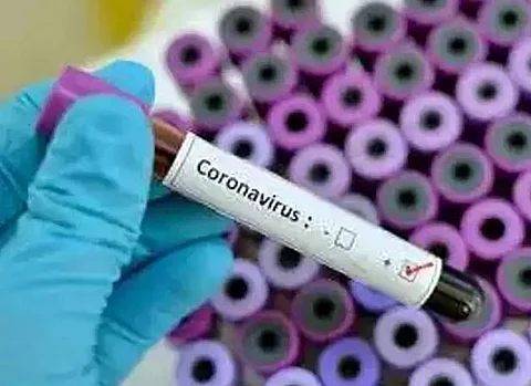 coronavirus