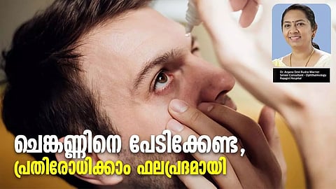 ചെങ്കണ്ണിനെ പേടിക്കേണ്ട, പ്രതിരോധിക്കാം ഫലപ്രദമായി; ഡോ. അഞ്ജന ദേവി എഴുതുന്നു