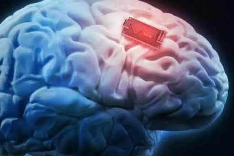 തലച്ചോറില് ചിപ്പ് ഘടിപ്പിച്ചാല് എന്ത് സംഭവിക്കും?