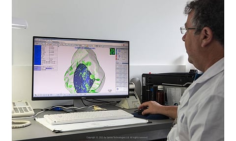 Sarine Technologies Reports FY2024 Profit Amid Industry Headwinds