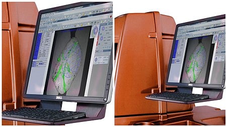 Sarine' s Meteor™ System