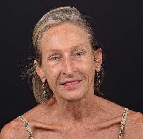 Lilian Kopke