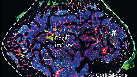 Corte transversal de tecido ósseo obtido por microscopia de fluorescência, mostrando a separação entre o osso cortical (camada exterior) e a medula óssea, onde a equipa mapeou os vasos linfáticos.