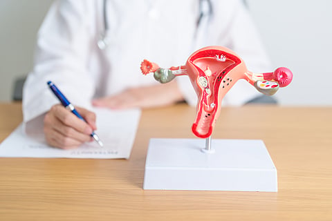 Cancro do endométrio e do ovário: aposta na literacia