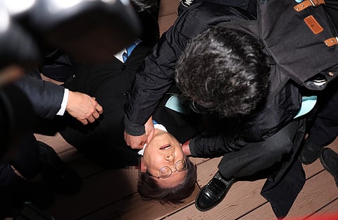 EPA/YONHAP SOUTH KOREA OUT