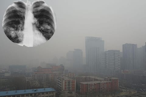 फोटो : विकिमीडिया कॉमन्स