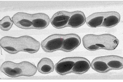 मूंगफली की एक्स-रे से ली गई छवि; फोटो: इंटरनेशनल क्रॉप्स रिसर्च इंस्टीट्यूट फॉर द सेमी-एरिड ट्रॉपिक्स (इक्रीसेट)