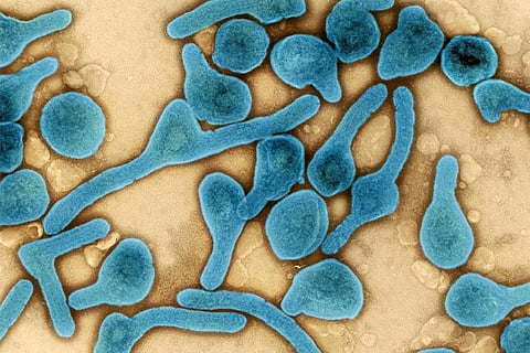 फोटो साभार : विकिमीडिया कॉमन्स, एनआईएआईडी, मारबर्ग वायरस के अणु