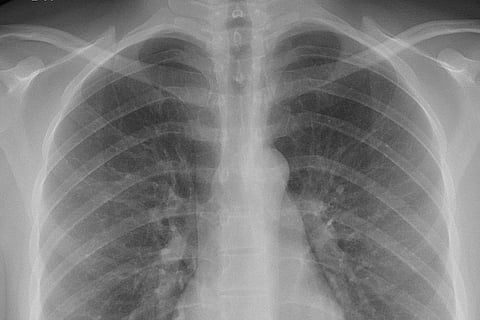 फोटो साभार: विकिमीडिया कॉमन्स, मिकेल हैगस्ट्रॉम