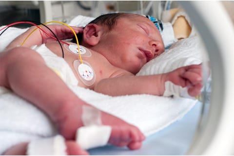 इनक्यूबेटर में नवजात शिशु; प्रतीकात्मक तस्वीर: आईस्टॉक