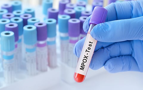 കേരളത്തിലെ സാമ്പിളുകൾ ആഗോള ക്ലേഡ് ഐബി എംപോക്സ് സ്ട്രെയിൻ സ്ഥിരീകരിച്ചു,