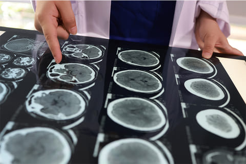 एमआरआई स्कैन की मदद से रोगी के दिमाग की जांच करते डॉक्टर; फोटो: आईस्टॉक