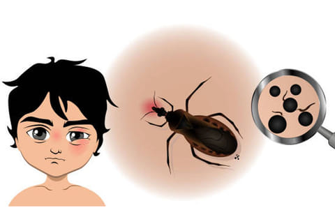 वर्षों बाद यह बीमारी दिल का दौरा और स्ट्रोक जैसी जानलेवा स्थिति पैदा कर सकती है।