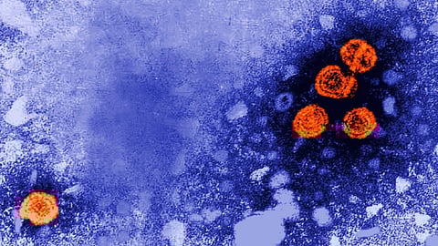 This 1981 electron microscope image made available by the U.S. Centers for Disease Control and Prevention shows hepatitis B virus particles, indicated in orange.
(Photo: AP)