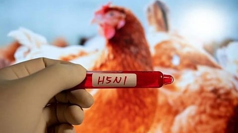 Representative image