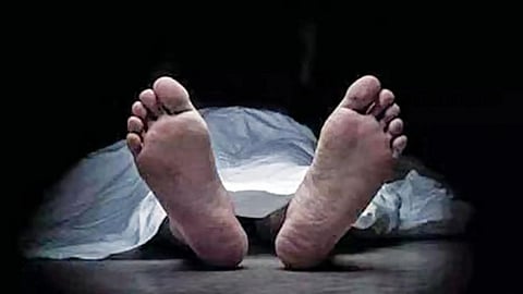 Representative image