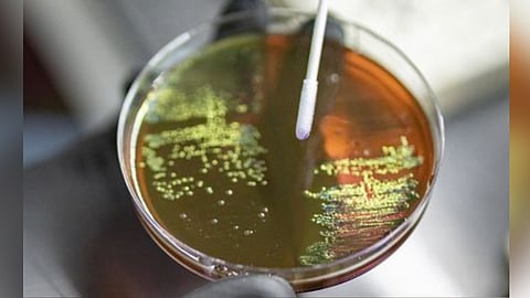 Representative Image