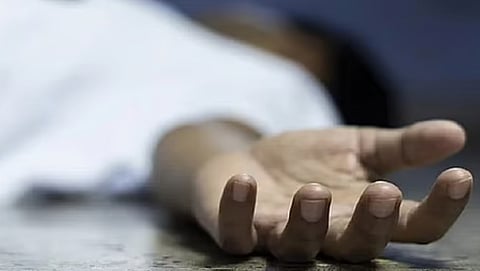 Representative Image