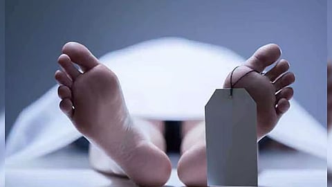 Representative Image