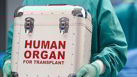 The above image is a representational image