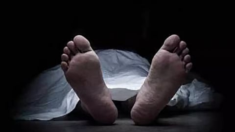 Representative Image