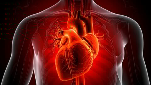 Representative Image