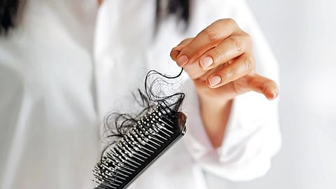 DT Next Tress Talk | Hair fall after joining college: When should you worry ?
