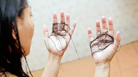 Hair fall