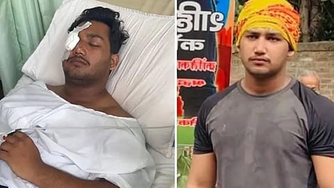 Sahil Lochab was allegedly hit by a pellet gun in his right eye during the Cockroach Janta Party (CJP) protest in Delhi on June 20.