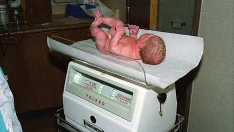 Child birth