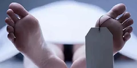 Representative image