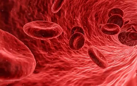 Representative image