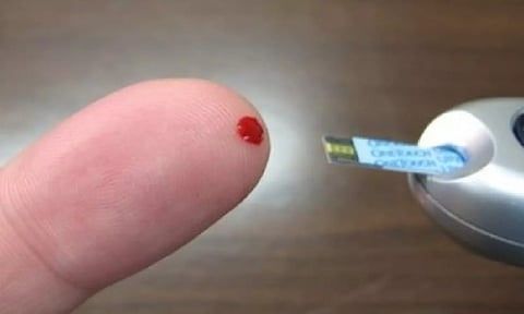 Representative image