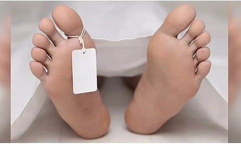 Representative image