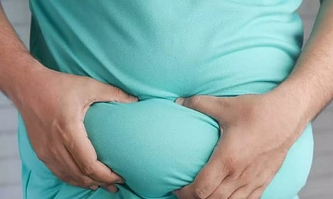 Representative Image