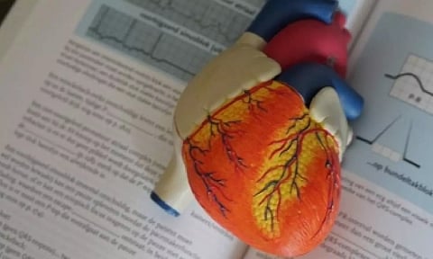 Representative image