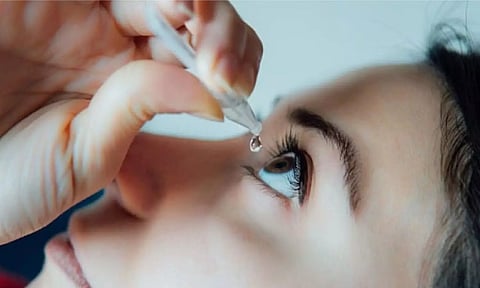 Representative image