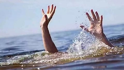 Representative Image