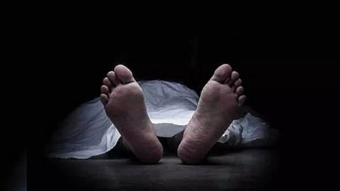 Representative Image