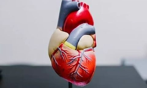 Representative Image