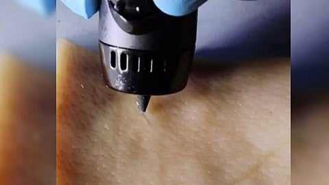 Representative Image