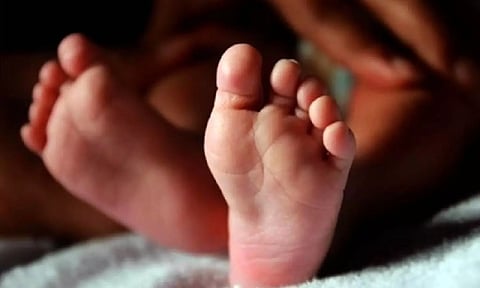 Representative image